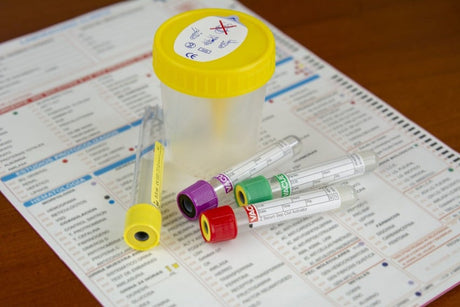 ¿Qué analíticas debería hacerme para saber cómo estoy a nivel de salud?